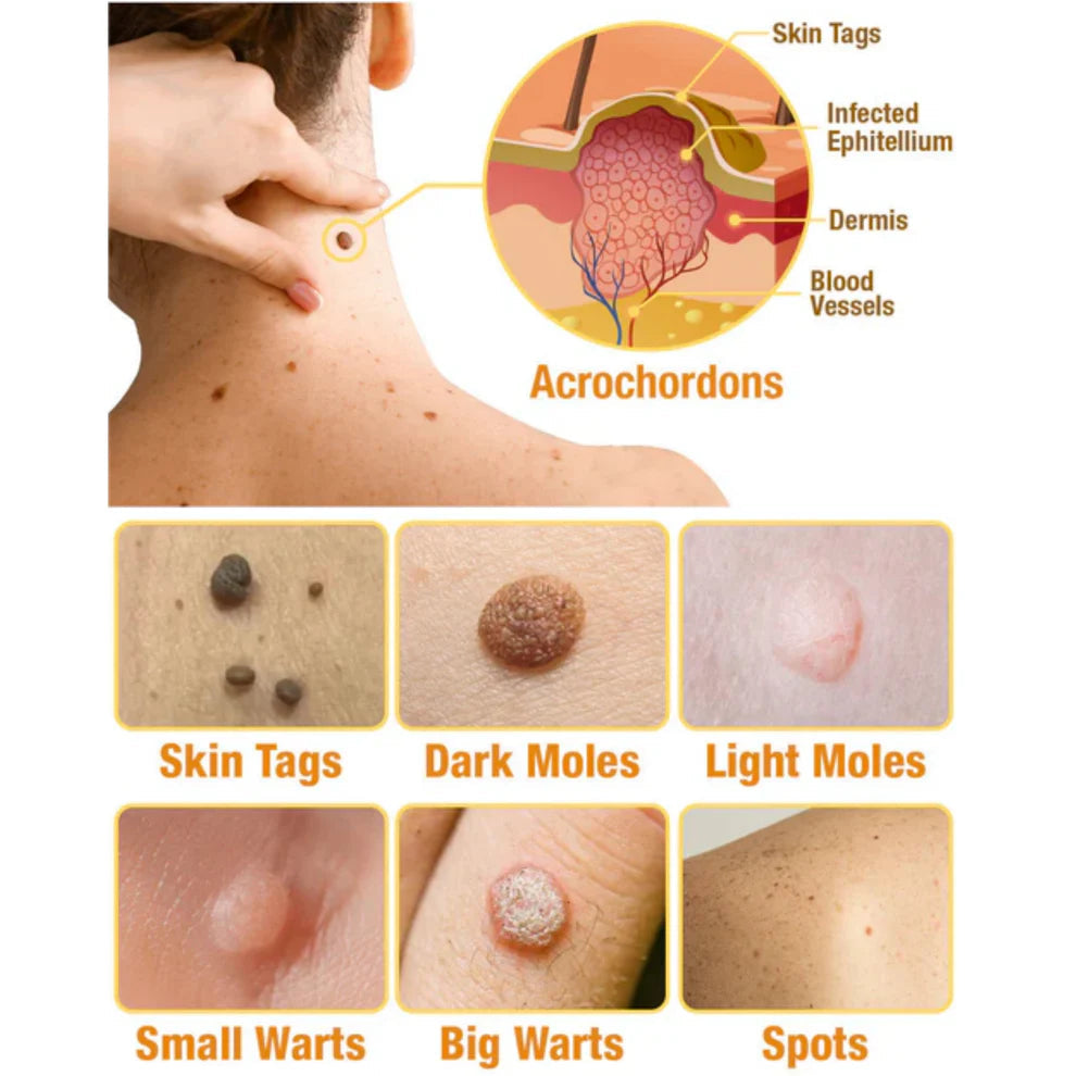 3x1 BeeFix™ – Elimina verrugas en segundos +🎁 Manual de regeneración capilar y secretos para lucir más atractivo GRATIS + Envío Gratis